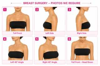 Example: Breast Surgery