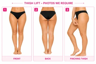 Example: Thigh Lift